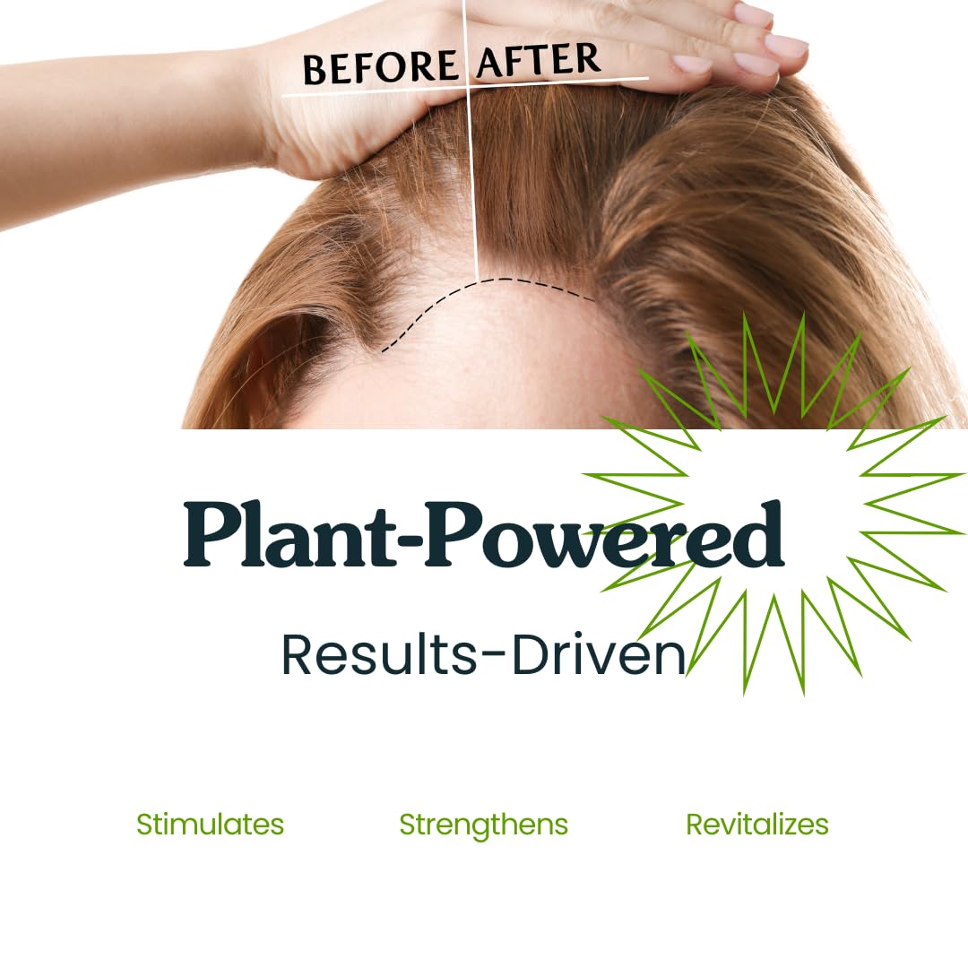 Isabella's Clearly GAIN, Hair Thickening Serum for Men and Women | Natural Herbal Scalp Oil with Castor, Jojoba, Clary Sage, Rosemary, Nettle Extract for Hair Loss, Thinning Hair | Made in USA