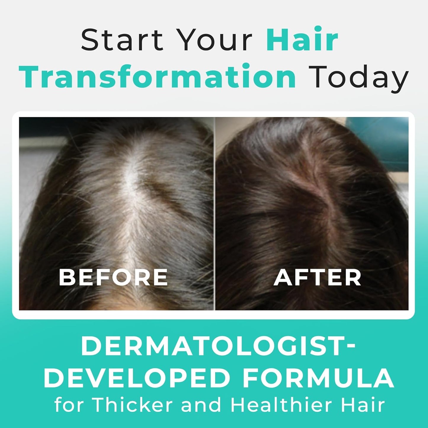 Hair Plus MD Hair Growth Supplement, 120 Capsules – Supports Hair Growth & Density – Dermatologist-Developed with Collagen & Vitamins – Gluten-Free, Toxin-Free, Non-GMO – 1 Month Supply