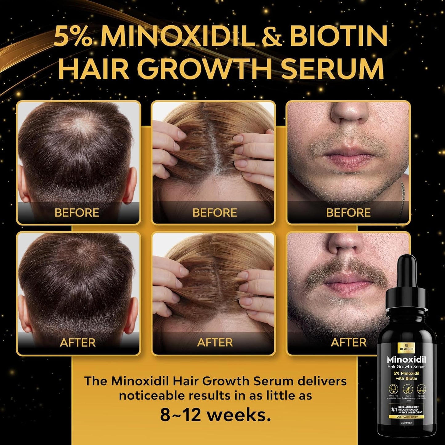 5% Minoxidil Hair Growth for Men and Women: Extra Strength Minoxidil Beard Regrowth Treatment Serum with Biotin for Thinning Hair Loss to Grow Thicker Fuller 30ml 6 Bottles